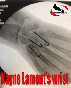 Lamont wrist-Feb 2015-b